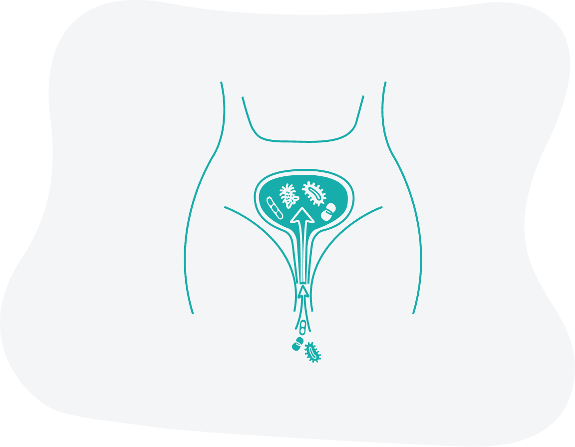 Як виникає цистит